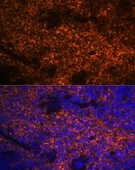 Hemoglobin alpha Antibody in Immunohistochemistry (Paraffin) (IHC (P))