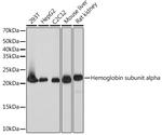 DHFR Recombinant Rabbit Monoclonal Antibody (7N3X4)