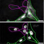 MUNC18 Recombinant Rabbit Monoclonal Antibody (1N7U1)