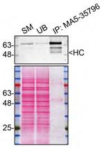 MUNC18 Antibody in Immunoprecipitation (IP)