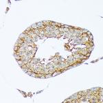 Cortactin Antibody in Immunohistochemistry (Paraffin) (IHC (P))