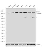 FANCA Antibody in Western Blot (WB)
