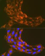 RPS20 Recombinant Rabbit Monoclonal Antibody (9H1D4)