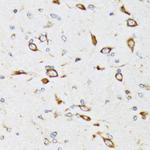 RPS20 Antibody in Immunohistochemistry (Paraffin) (IHC (P))