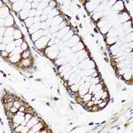 RPS20 Antibody in Immunohistochemistry (Paraffin) (IHC (P))