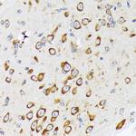 RPS20 Antibody in Immunohistochemistry (Paraffin) (IHC (P))