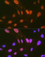 HIPK2 Recombinant Rabbit Monoclonal Antibody (3Z5P6)