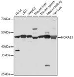 HOXA13 Recombinant Rabbit Monoclonal Antibody (5K0D5)