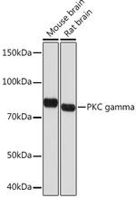 PKC gamma Recombinant Rabbit Monoclonal Antibody (5F2X3)