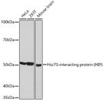 HIP Antibody in Western Blot (WB)