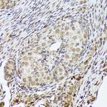 PSMD14 Antibody in Immunohistochemistry (Paraffin) (IHC (P))