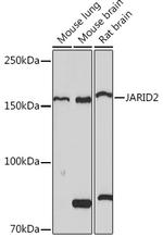 JARID2 Recombinant Rabbit Monoclonal Antibody (3L5C5)