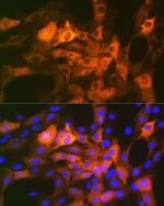 CRYAB Recombinant Rabbit Monoclonal Antibody (6C9R1)