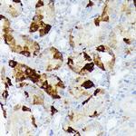 CRYAB Antibody in Immunohistochemistry (Paraffin) (IHC (P))