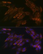 DDX6 Recombinant Rabbit Monoclonal Antibody (6F9I6)