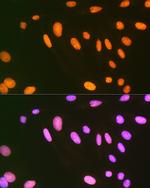 EWSR1 Antibody in Immunocytochemistry (ICC/IF)