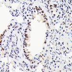 EWSR1 Antibody in Immunohistochemistry (Paraffin) (IHC (P))