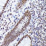 EWSR1 Antibody in Immunohistochemistry (Paraffin) (IHC (P))
