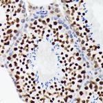 EWSR1 Antibody in Immunohistochemistry (Paraffin) (IHC (P))