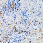 DC-SIGN Antibody in Immunohistochemistry (Paraffin) (IHC (P))