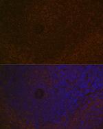 CARD11 Antibody in Immunohistochemistry (Paraffin) (IHC (P))