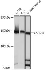 CARD11 Antibody in Western Blot (WB)