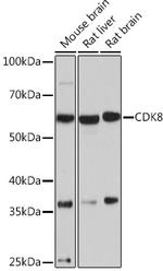 CDK8 Recombinant Rabbit Monoclonal Antibody (7L5X2)