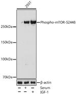 Phospho-mTOR (Ser2448) Recombinant Rabbit Monoclonal Antibody (4O6A9)