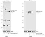 Phospho-beta Catenin (Ser33, Ser37) Recombinant Rabbit Monoclonal Antibody (6C1Q1)