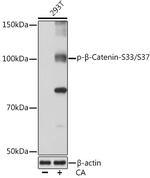 Phospho-beta Catenin (Ser33, Ser37) Antibody in Western Blot (WB)