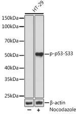 Phospho-p53 (Ser33) Recombinant Rabbit Monoclonal Antibody (2Y4T8)