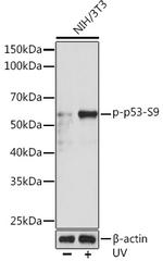 Phospho-p53 (Ser9) Recombinant Rabbit Monoclonal Antibody (10U5R6)