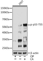 Phospho-p53 (Thr55) Recombinant Rabbit Monoclonal Antibody (7I0A7)
