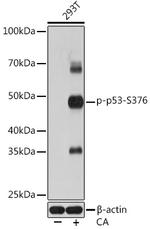 Phospho-p53 (Ser376) Recombinant Rabbit Monoclonal Antibody (2S2L0)