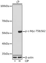 Phospho-c-Myc (Thr58, Ser62) Recombinant Rabbit Monoclonal Antibody (10F1V1)