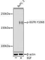 Phospho-EGFR (Tyr1068) Recombinant Rabbit Monoclonal Antibody (9U5H0)