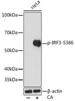 Phospho-IRF3 (Ser386) Recombinant Rabbit Monoclonal Antibody (6D3D1)