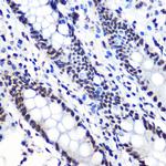 Phospho-IkB alpha (Ser36) Antibody in Immunohistochemistry (Paraffin) (IHC (P))