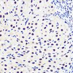 Phospho-IkB alpha (Ser36) Antibody in Immunohistochemistry (Paraffin) (IHC (P))