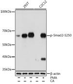 Phospho-SMAD2 (Ser250) Recombinant Rabbit Monoclonal Antibody (10M1E3)