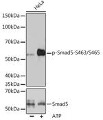 Phospho-Smad5 (Ser463,Ser465) Recombinant Rabbit Monoclonal Antibody (8F4B10)