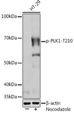 Phospho-PLK1 (Thr210) Recombinant Rabbit Monoclonal Antibody (8G9X10)