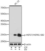 Phospho-HSP27 (Ser82) Recombinant Rabbit Monoclonal Antibody (2D1N1)