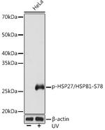 Phospho-HSP27 (Ser78) Recombinant Rabbit Monoclonal Antibody (4R7E5)