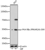 Phospho-PRKAR2A (Ser99) Recombinant Rabbit Monoclonal Antibody (8K9F9)