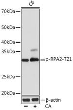 Phospho-RPA2 (Thr21) Recombinant Rabbit Monoclonal Antibody (4I3A0)