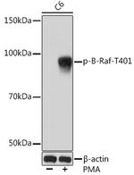 Phospho-BRAF35 (Thr401) Recombinant Rabbit Monoclonal Antibody (5G6Q5)
