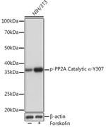 Phospho-PP2A alpha (Tyr307) Recombinant Rabbit Monoclonal Antibody (9B7Z9)