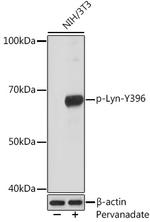 Phospho-Lyn (Tyr396) Recombinant Rabbit Monoclonal Antibody (5I5G8)