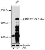 Phospho-ErbB3 (Tyr1222) Recombinant Rabbit Monoclonal Antibody (5Z1F0)